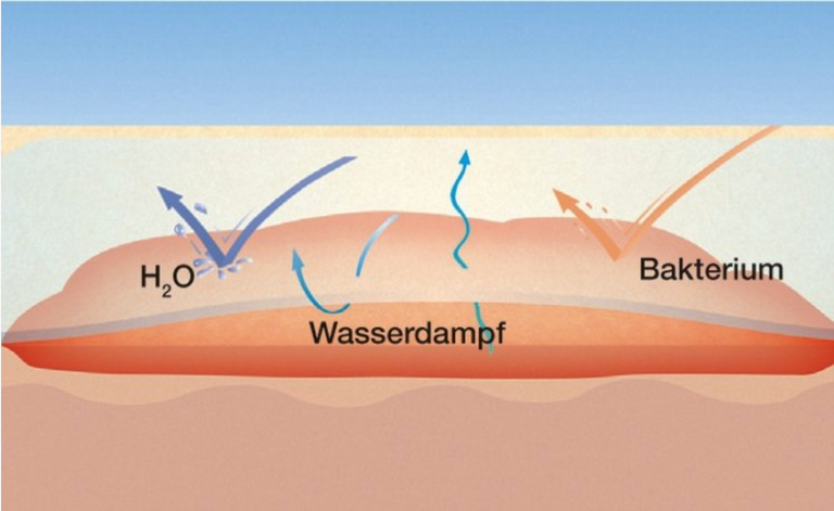 Suprasorb F Film Dressing – Various Sizes